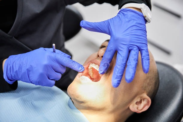 Best Knocked-Out Tooth (Avulsed Tooth) Treatment in Goodman, MS